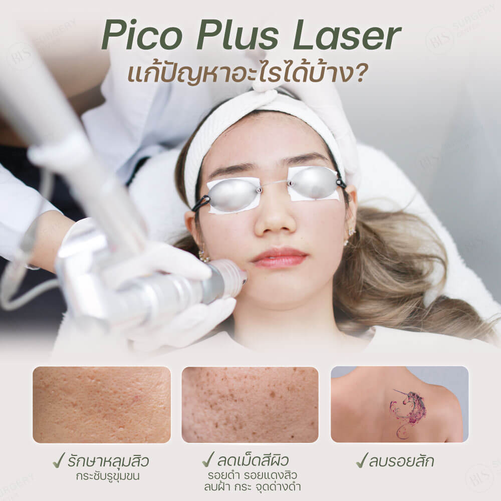 Pico Laser แก้ปัญหาอะไรได้บ้าง?
