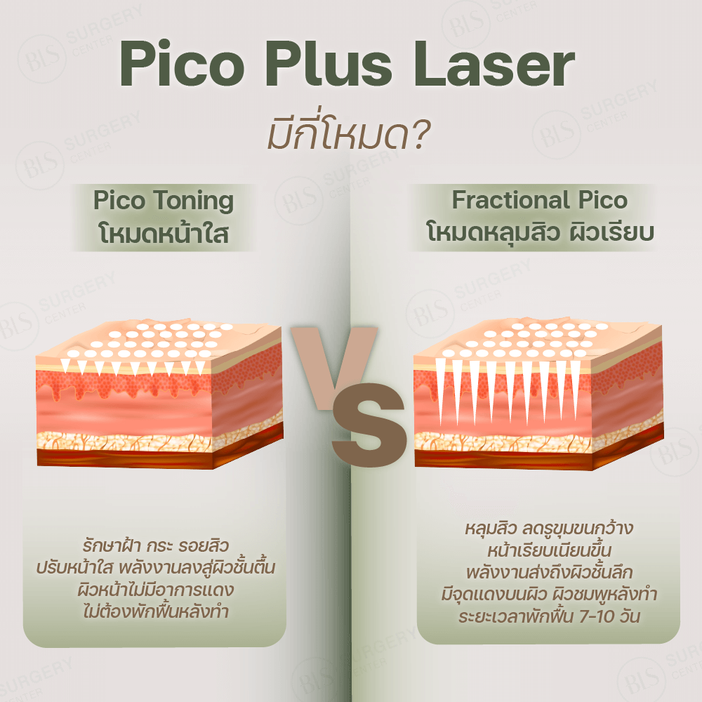 Pico Laser มีกี่แบบ? ในการรักษา