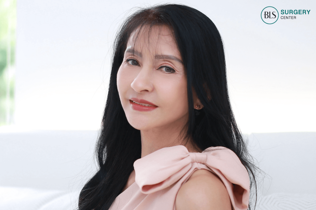 หลัง ผ่าตัดดึงหน้า (Face lift) + ยกกระชับลำคอ (Neck Lift) 3 เดือน