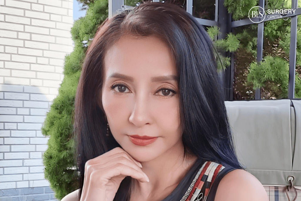 ผลลัพธ์จากการดึงหน้าอยู่ได้กี่ปี?