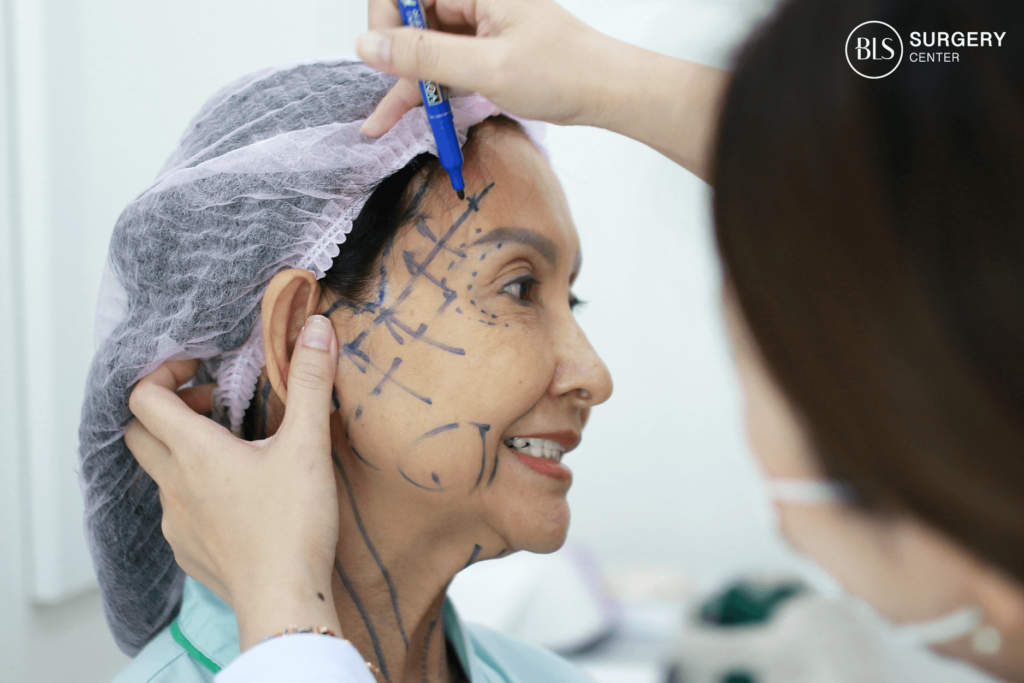 Face lift ผ่าตัดดึงหน้า ช่วยยกกระชับบริเวณกรอบหน้า