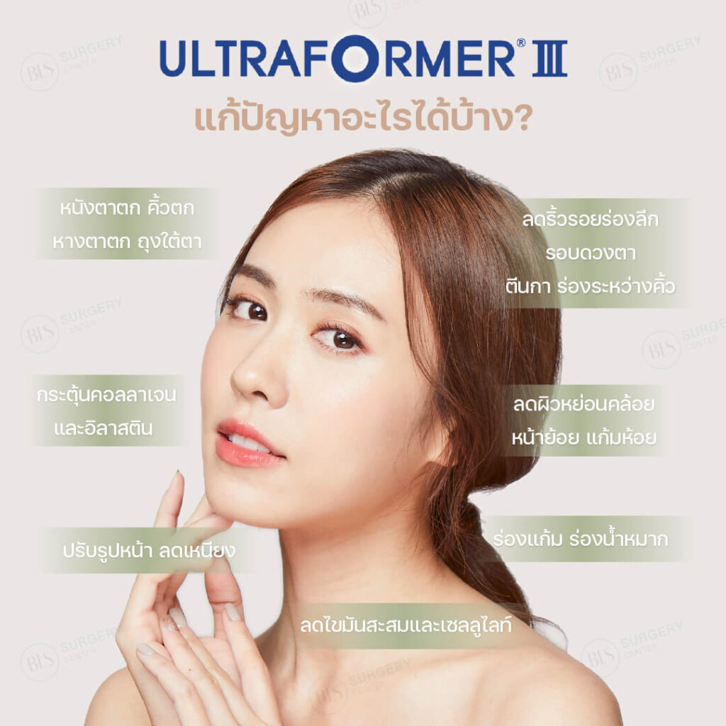 เลเซอร์ยกกระชับหน้า Ultraformer III แก้ปัญหาอะไรได้บ้าง?