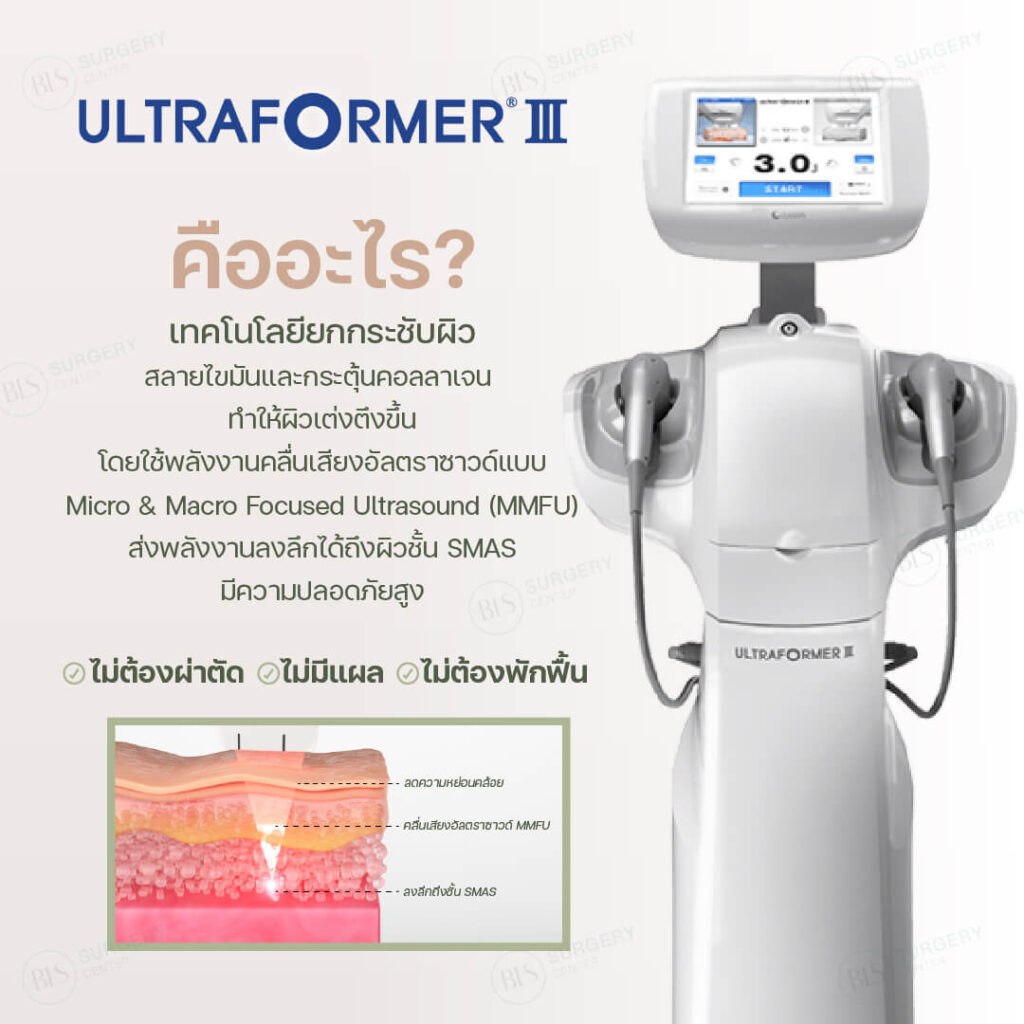 เลเซอร์ยกกระชับหน้า Ultraformer III คืออะไร? หมอบีม Facial Expert มีคำตอบ