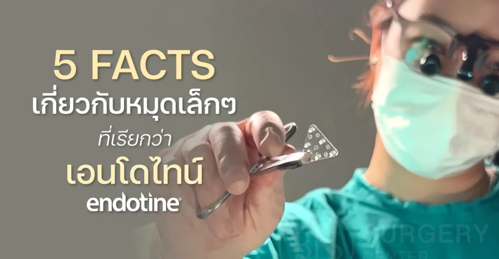 5 Facts เกี่ยวกับหมุดเล็กๆ ที่เรียกว่า เอนโดไทน์ (Endotine)