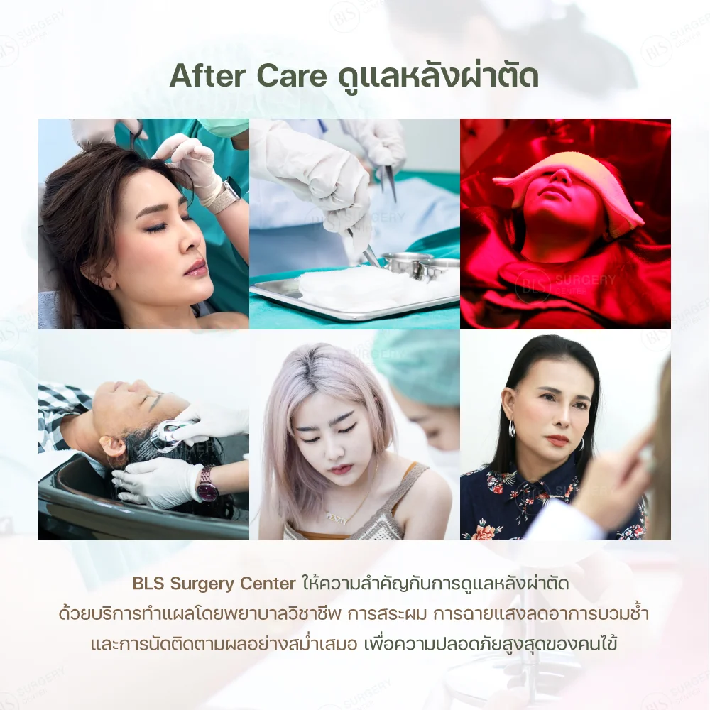 ดึงหน้าที่ไหนดี ศัลยกรรมดึงหน้าที่ BLS Surgery Center